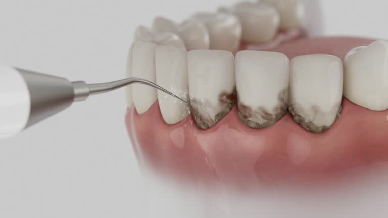 Reliable Dental Implants contractor in Noroton Heights, CT by Smile Center Dentistry